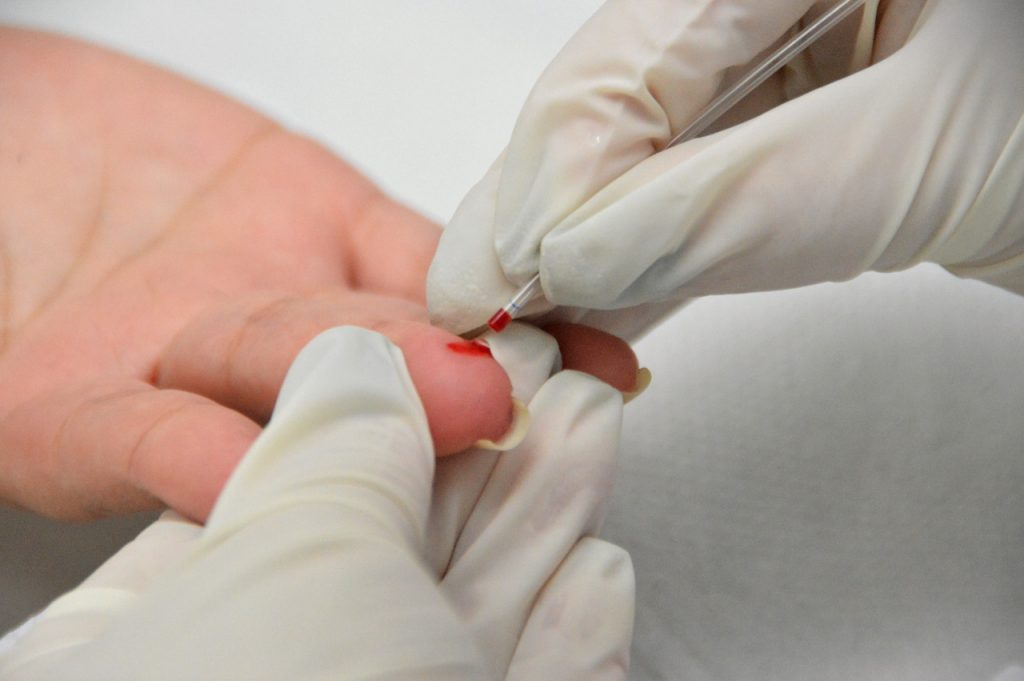 Os testes são ofertados para qualquer pessoa, sintomática ou não.